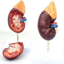 KIDNEY05 (12434) Normal Kidney 2 Partie 1.5 temps Agrandir Vie Taille Anatomie médicale Urinaire